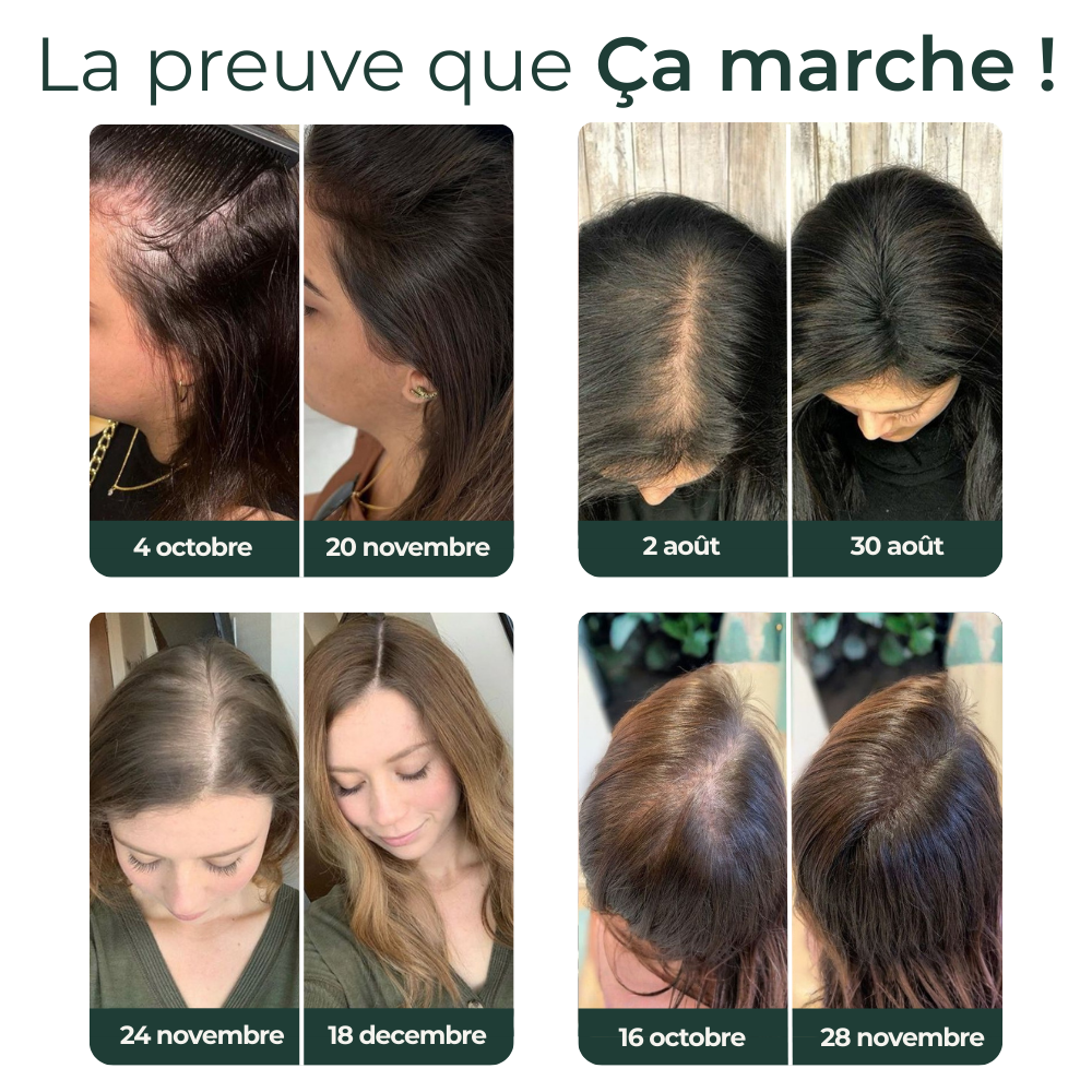 BLUNEA™ Shampoing Volume & Repousse