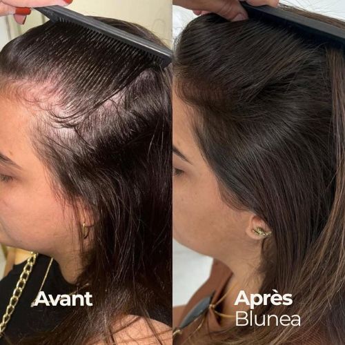 BLUNEA™ Shampoing Volume & Repousse