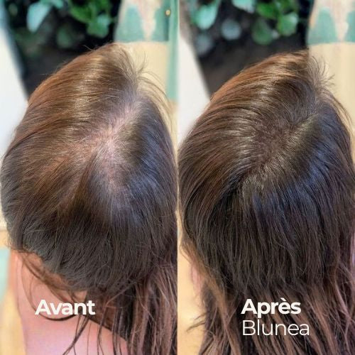 BLUNEA™ Shampoing Volume & Repousse