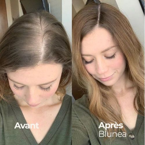 BLUNEA™ Shampoing Volume & Repousse